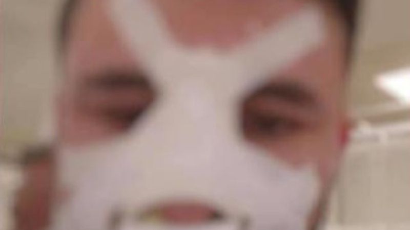 Konya'da sağlık çalışanının burnunu kırdı, serbest kaldı