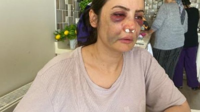Kartal'da boşanmak istediği eşi tarafından darbedildi