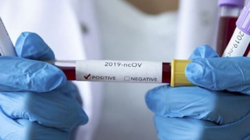 Dünya Sağlık Örgütü: Aşı milliyetçiliği yapılmasın