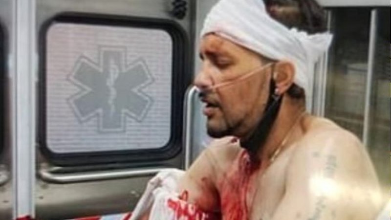 New York'ta bir adam kafasındaki bıçakla sokaklarda gezdi