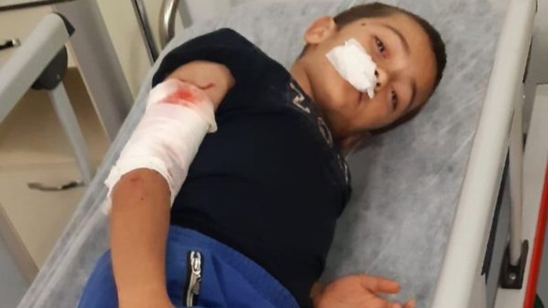 Sultangazi'de 8 yaşındaki Ubeyde'ye köpek saldırdı