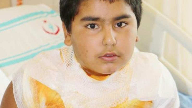 Erzincan'da üzerine kolonya döküp kendini yaktı