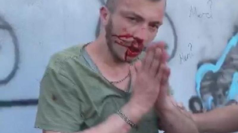 Pendik'te engelli genç, engelli gruptan dayak yedi