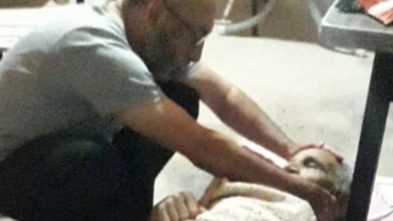 Osmaniye'de bacağından vurulan adam hayatını kaybetti