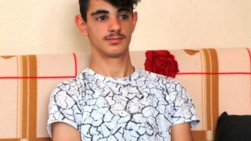 SLE hastası Savaş, evden çıkamıyor