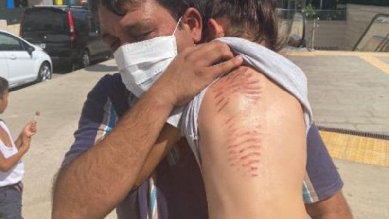 Saçları yürüyen merdivene sıkışan çocuğun son hali