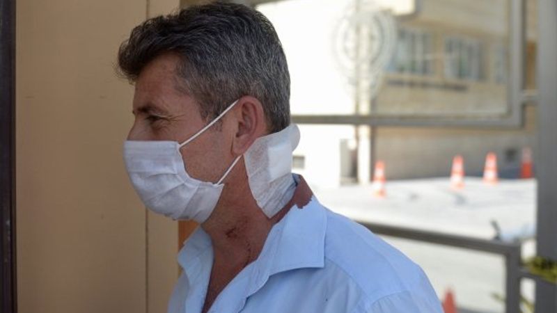 Eskişehir'de halk otobüsü şoförü satırlı saldırıya uğradı