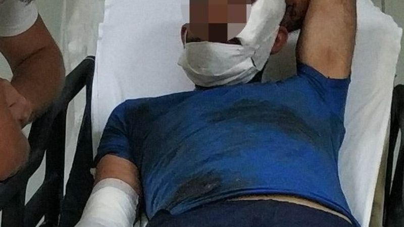 Samsun'da genç kadın kocasını bıçakla yaraladı