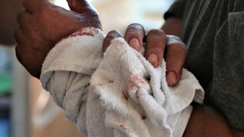 Acemi kasaplar hastanelik oldu