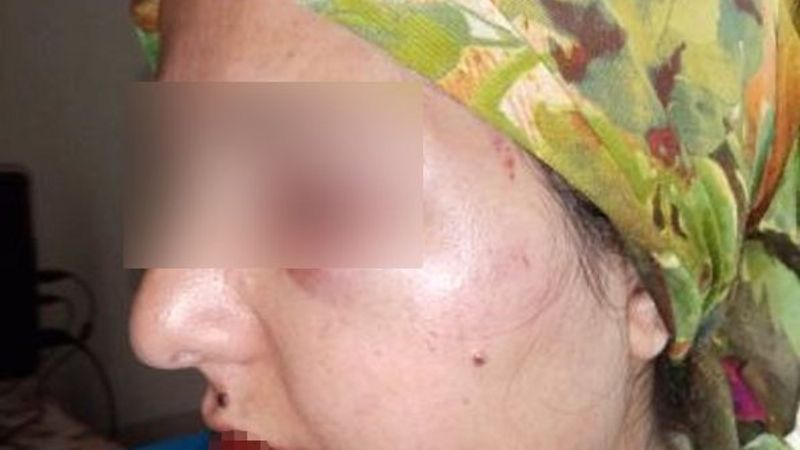 Hatay'da eşinden şiddet gören kadın: Artık dayanamıyorum