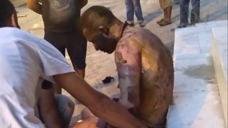 İzmir'de tinerciyi tiner dökerek yaktılar