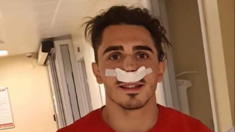 Abdülkadir Ömür burun ameliyatı oldu