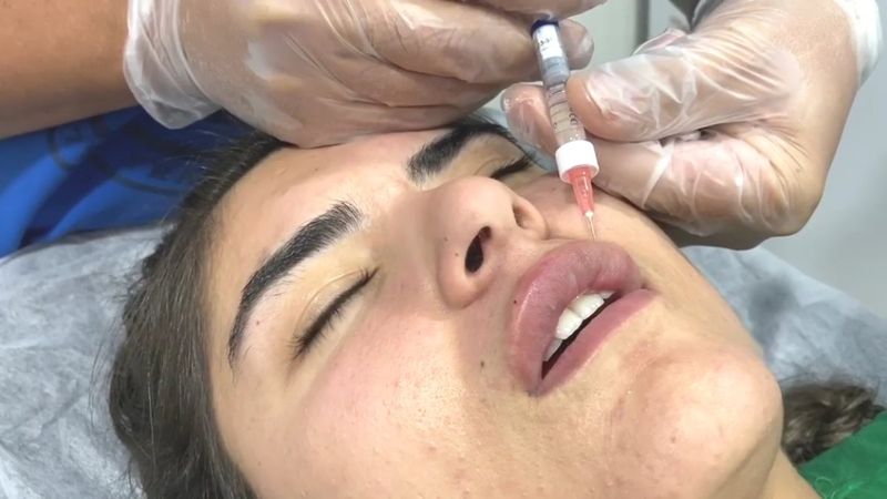 Hanife Gürdal, dudaklarını büyüttü