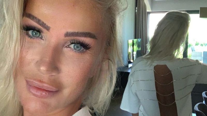 Seda Sayan'ın yeni dudakları