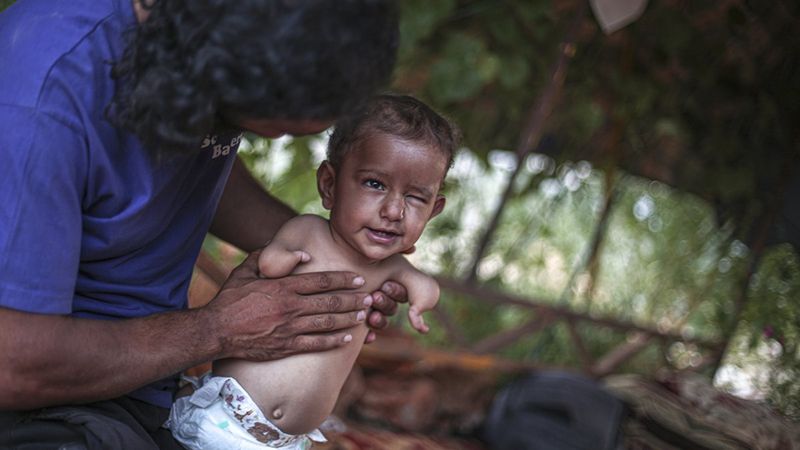 Kolları ve bacakları olmayan Muhammed bebek yardım bekliyor