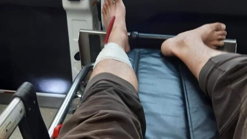 Kahramanmaraş'ta koli bantlarken kullandığı bıçağı baldırına sapladı