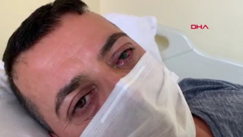 Çapa'da saldırıya uğrayan sağlık çalışanı: Şu an gözüm görmüyor