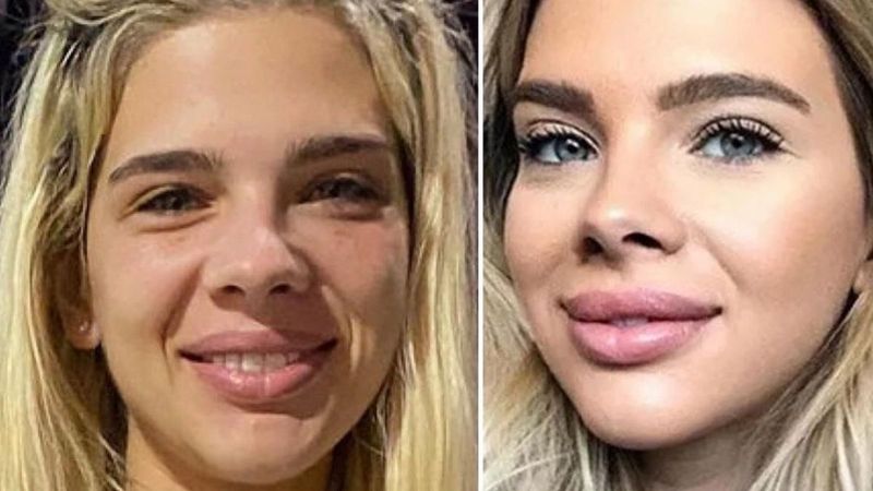 Damla Ersubaşı yüzündeki morlukların sebebini açıkladı! Şiddet gördüğü eşinden boşanan Damla Ersubaşı kimdir?