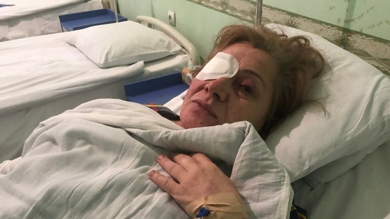 Gence'deki saldırıda yaralanan kadın o anları anlattı