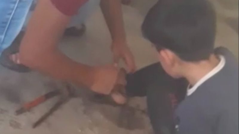 Bursa'da ayağından zincirlenmiş çocuk yangından kurtarıldı