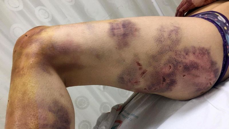 Şanlıurfa'da eşini eve kilitleyip günlerce işkence yaptı