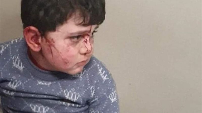 Ermenistan'dan Hocalı Katliamı'nı anımsatan saldırı