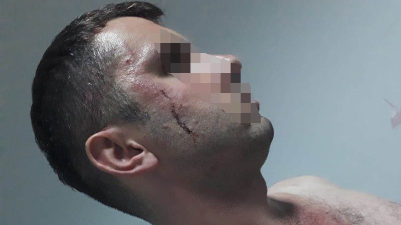 Samsun'da hasta bakıcı, hastanede darbedildi