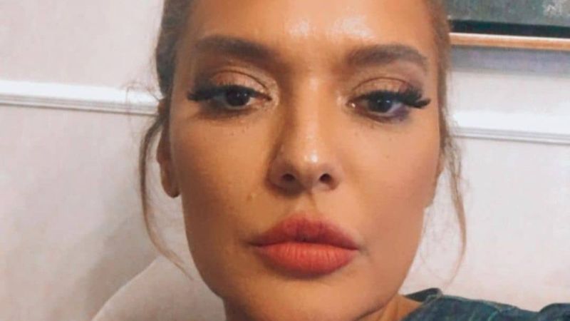 Demet Akalın, yeni dudaklarını çok beğendi