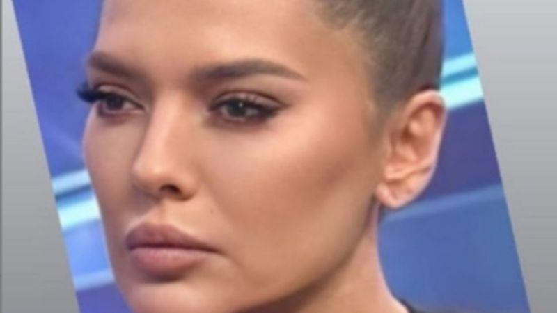 Demet Akalın'ın gençlik aşısı pişmanlığı