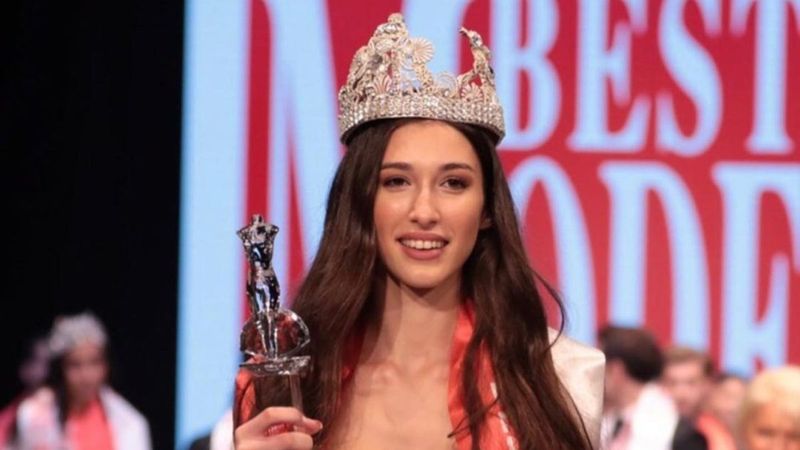 Best Model birincisi Melisa İmrak: Estetik yaptırmadım