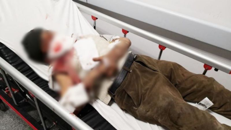 Aksaray'da komşusunun köpeği tarafından saldırıya uğradı