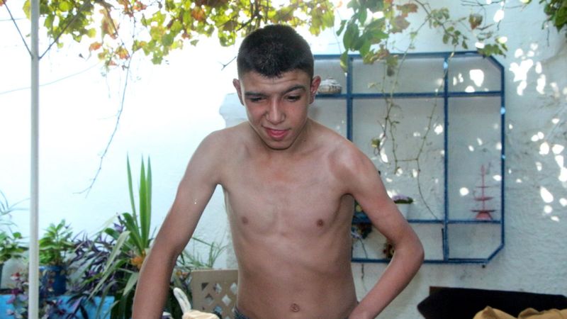 Yanan evde mahsur kalan engelli genci komşusu kurtardı