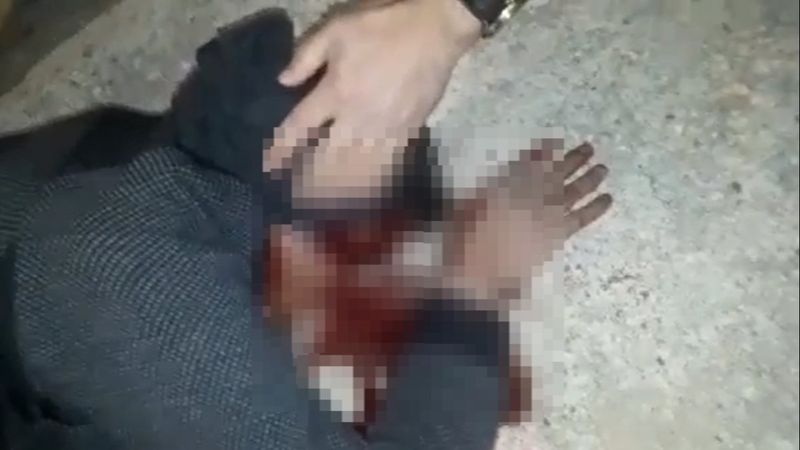 Çorum’da eşinin akrabalarına silahla saldırdı: 1 ölü, 3 yaralı