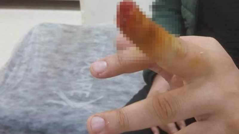 Samsun'da tartıştığı güvenlik görevlisinin parmağını kopardı