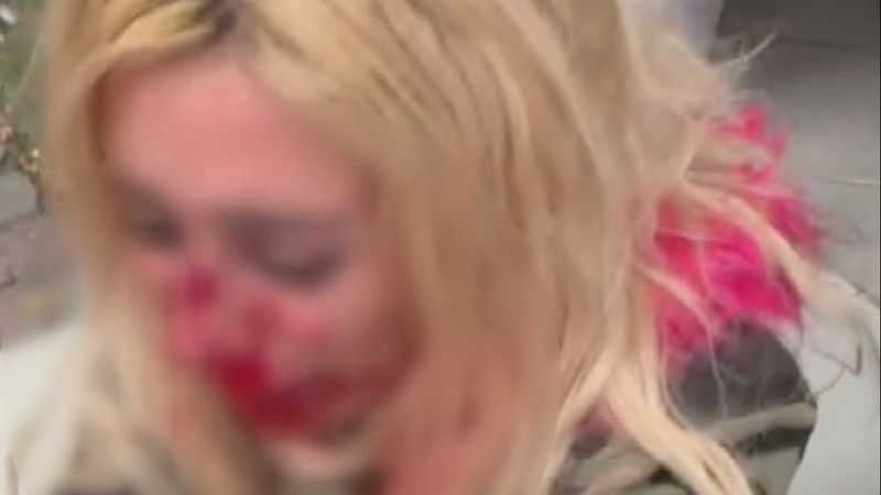 Gaziosmanpaşa'da darbedilen kadın kanlar içinde yola bırakıldı