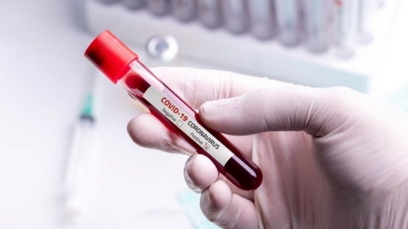 Koronavirüs riski en yüksek kan grubu hangisi? Koronavirüsü en hafif atlatan kan grubu hangisi?