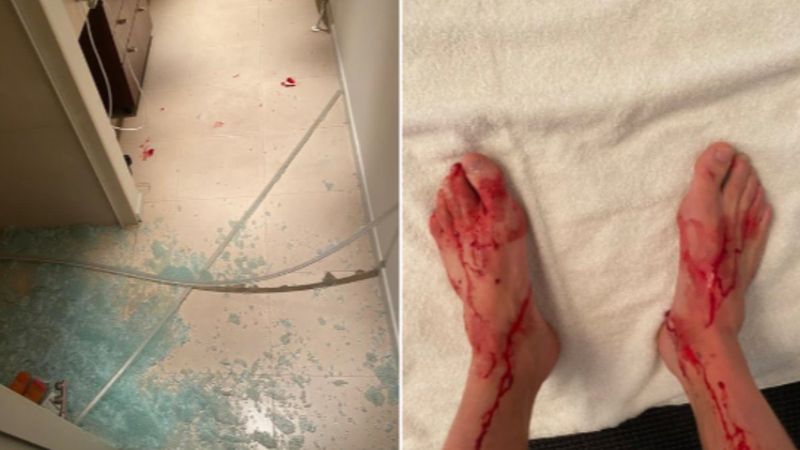 Sydney van Hooijdonk duşta mahsur kalınca ayaklarını parçaladı