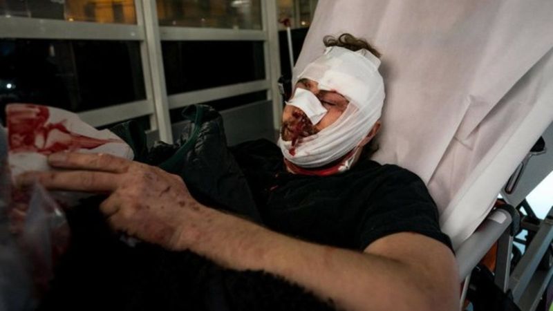 Fransa'da gazeteciye polis şiddeti