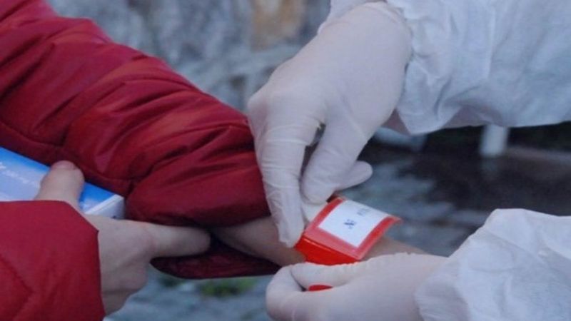 Koronavirüs bileklikleri nedir? E-bileklik uygulaması hangi illerde uygulanacak?