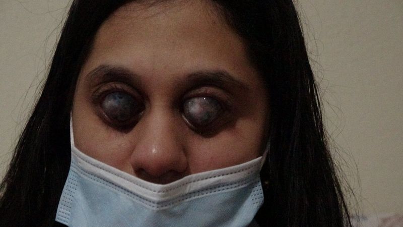 Balıkesir'de doğuştan görme engelli Ümran, yıldızları görmek istiyor