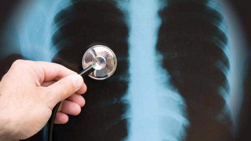 Koronavirüs öksürüğü nasıl anlaşılır? Koronavirüs ve kuru öksürük farkı nedir?