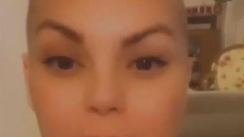 Nez saçlarını kazıttı