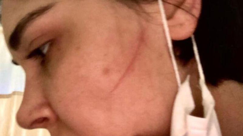 Sermiyan Midyat’ın şiddet uyguladığı güne ait görüntüler