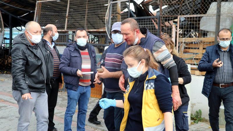 Denizli'de komşusunun kulağını ısırarak kopardı