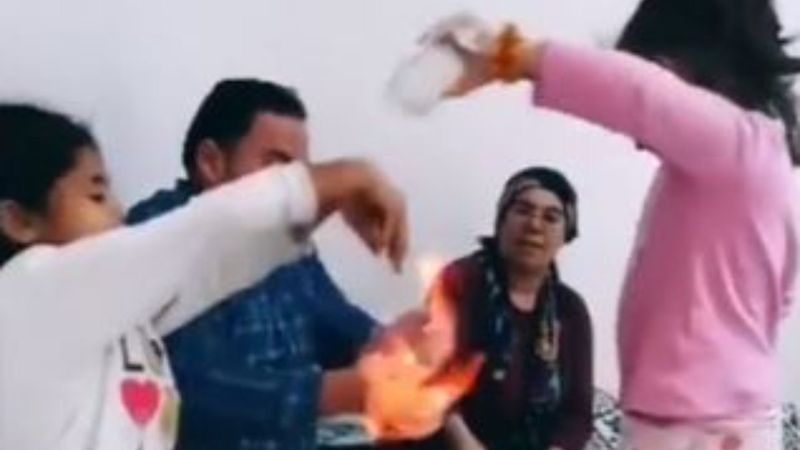 TikTok videosu için eşinin ellerini çakmakla yaktı