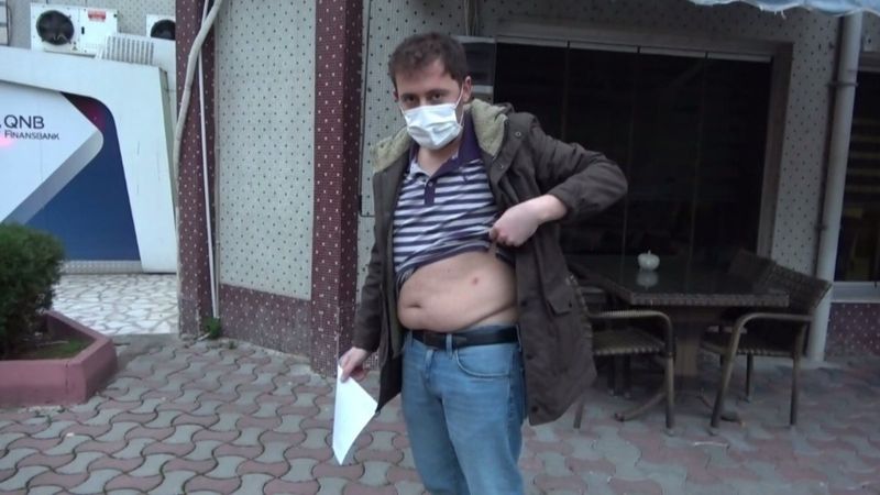 Samsun'da doktor çiftin ’korona’ kavgası karakolda bitti