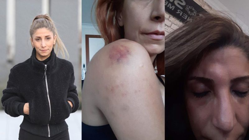 Ankara'da veteriner kadına sevgili şiddeti