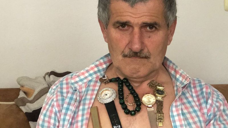 Sakarya'da vücudu, metali mıknatıs gibi çeken adam