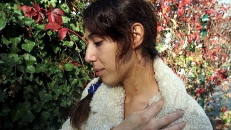 Antalya'da eski eşinin boğazını kesip, bıçakladı: Öldürme niyetim yoktu