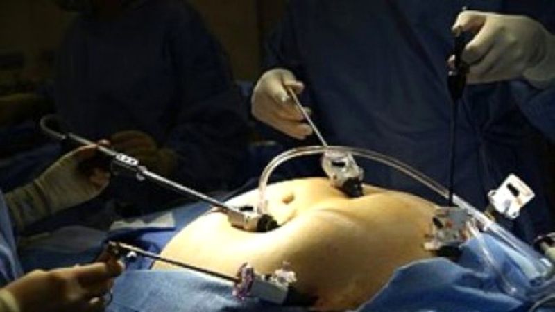 Geri dönüşüm ameliyatı nedir? Geri dönüşüm ameliyatı riskli mi, nasıl yapılır?